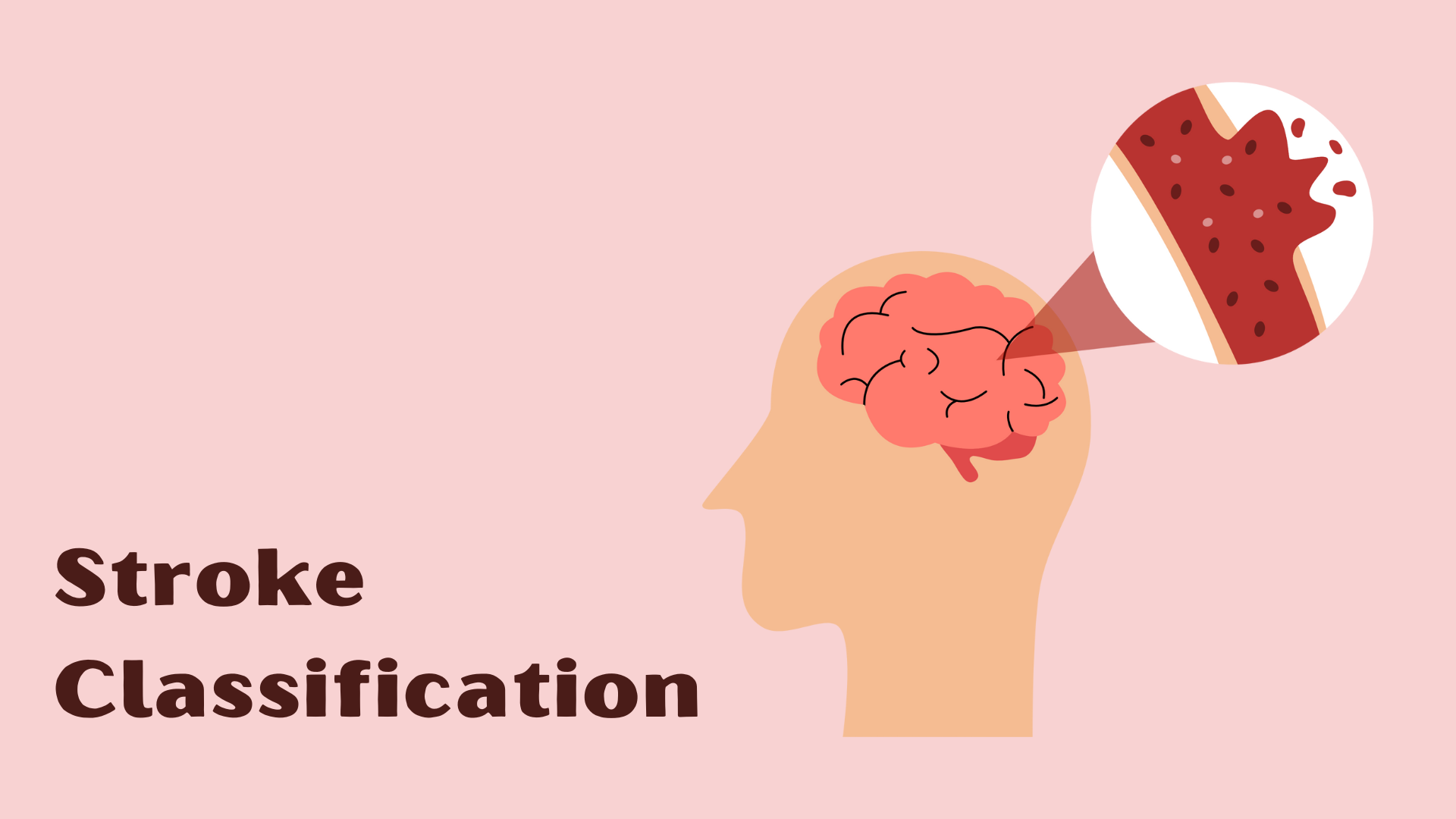 stroke-classification